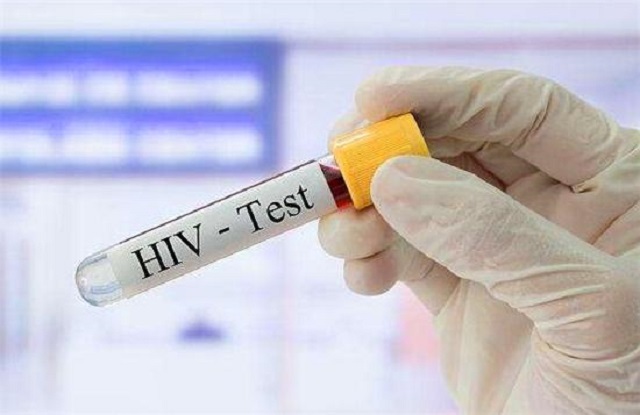 人体内可以抑制HIV复制的天然免疫因子有哪些？
